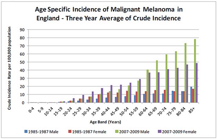 Data showing growth in UK melanoma rates