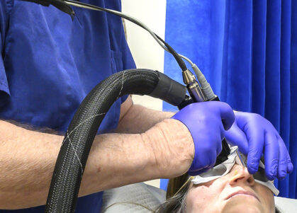 laser treatment